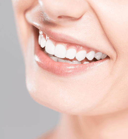 Teeth Whitening